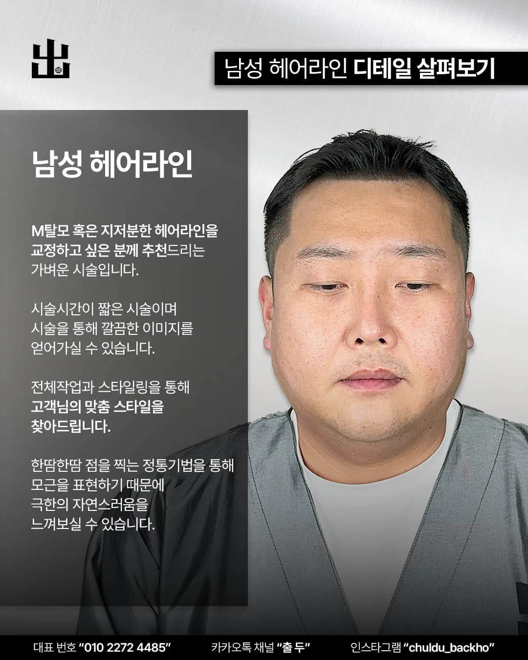 남성 헤어라인 두피문신 시술 설명과 시술 후 정면 사진