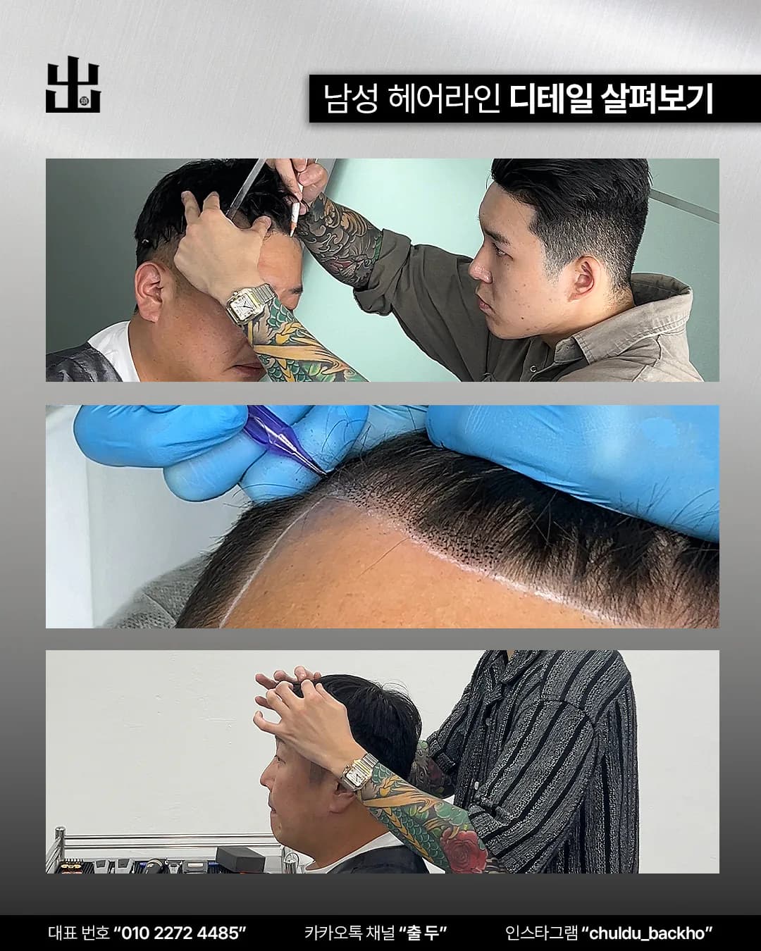 남성 헤어라인 두피문신의 디자인 드로잉, 니들 작업, 상담 과정 사진